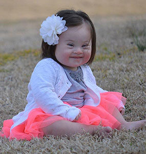 Down-syndrome2-285x