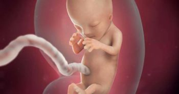 Unborn Child