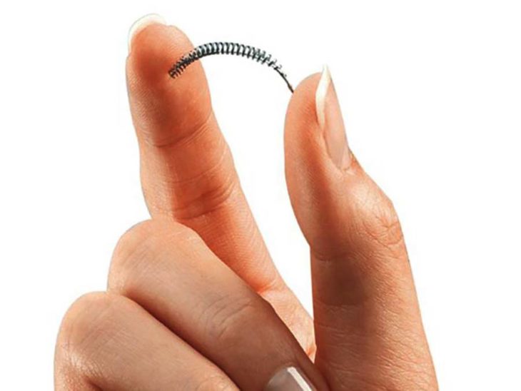 Essure Sterilization Device