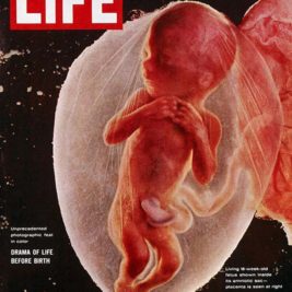 Lennart Nilsson, captured the first photographs of unborn babies in their mothers womb